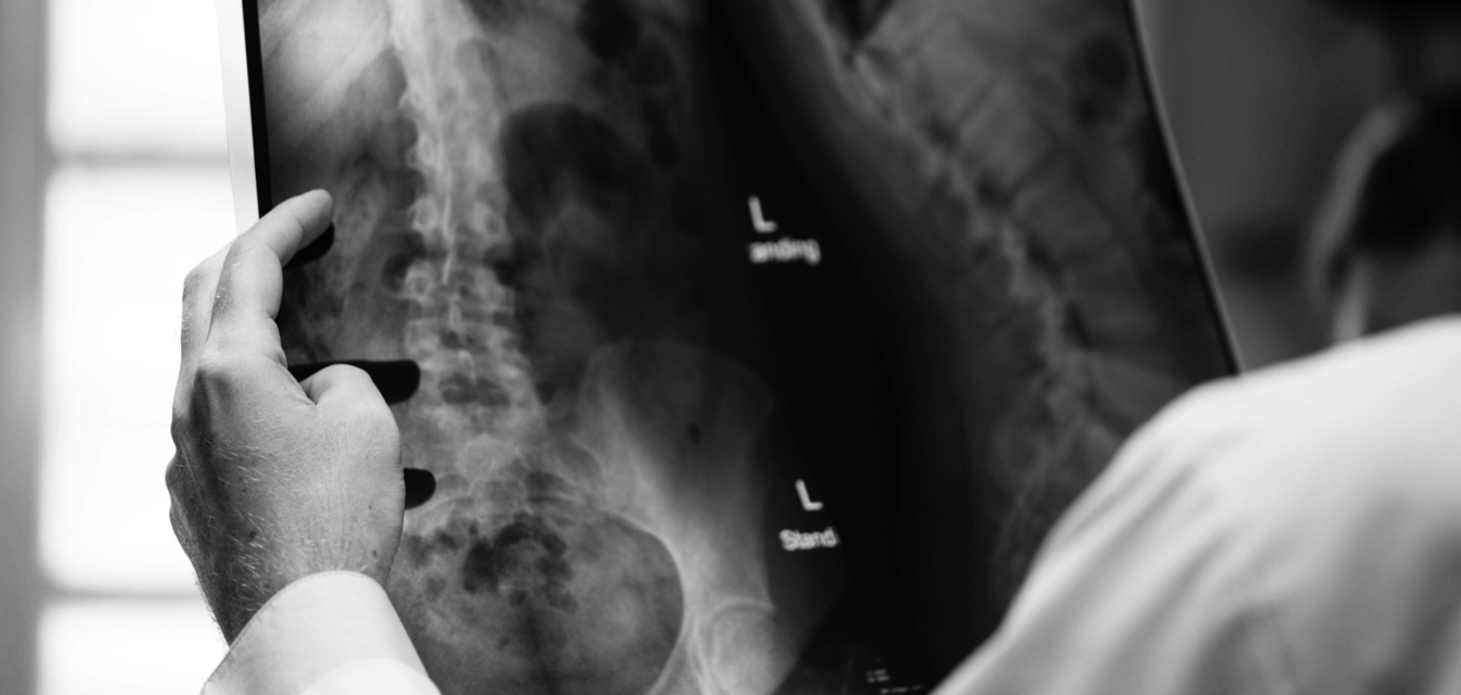 Perosnal Injury And Product Liability 278Kb